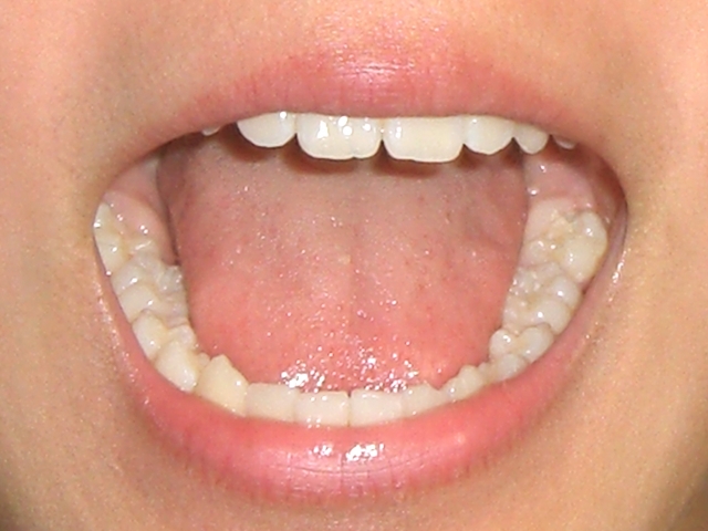 口の健康を“口腔年齢”でチェック
